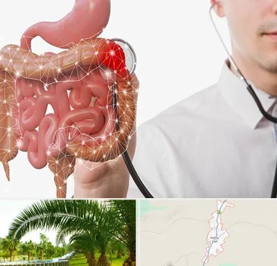 دکتر سرطان روده بزرگ در کهنوج