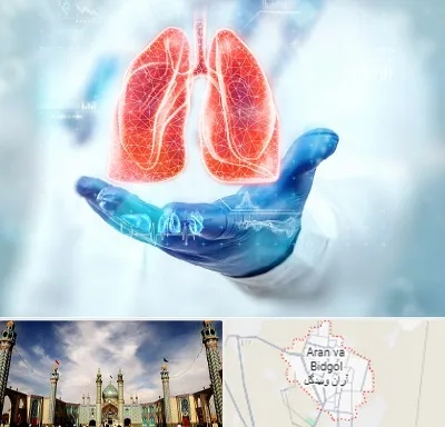 بیمارستان ریه در آران و بیدگل