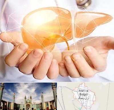 دکتر سرطان کبد در آران و بیدگل
