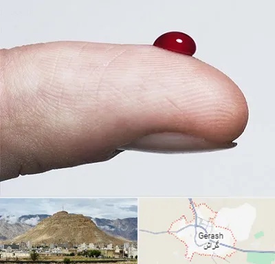 مرکز فصد خون در گراش