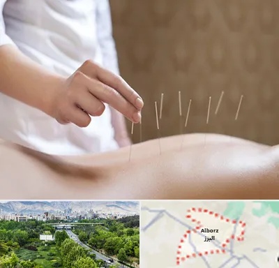 درای نیدلینگ در البرز