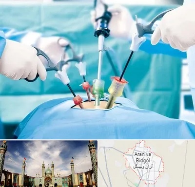 دکتر لاپاراسکوپی در آران و بیدگل