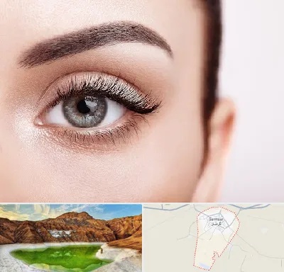 فوق تخصص عنبیه در گرمسار