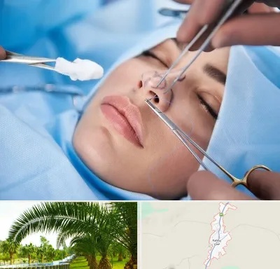 عمل ترمیمی بینی در کهنوج