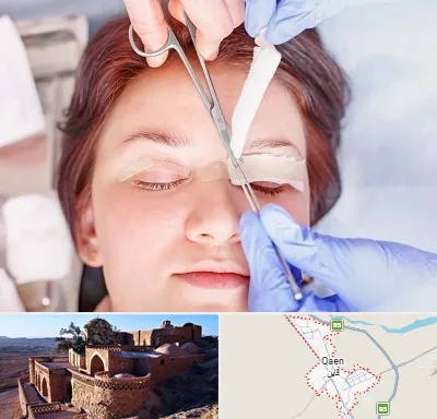جراحی پلک افتاده در قائن