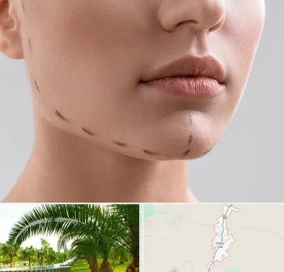 عمل زاویه فک در کهنوج