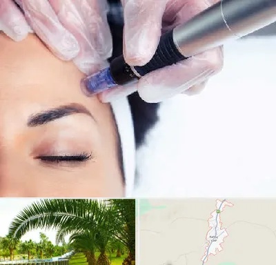 کلینیک مزوتراپی صورت در کهنوج