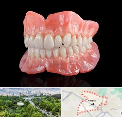 ساخت دندان مصنوعی در البرز