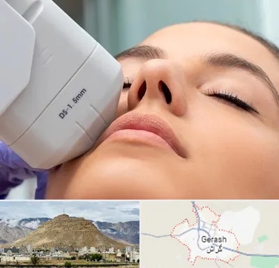 هایفوتراپی در گراش