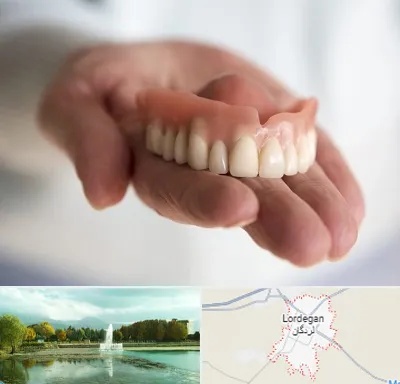 لیفت لثه با لیزر در لردگان