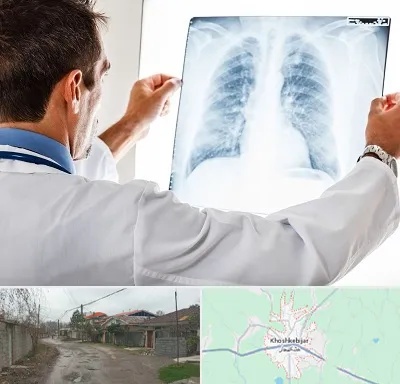 دکتر متخصص ریه در خشکبیجار