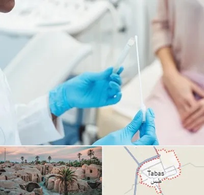 دکتر زگیل تناسلی HPV در طبس