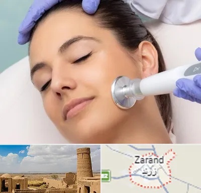 پلاسما جت در زرند