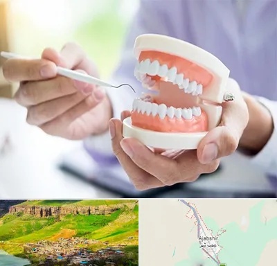 دندانسازی در عجب شیر