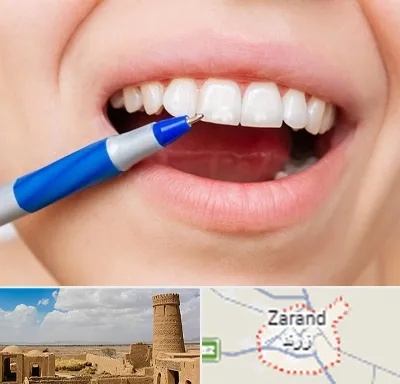 دندانسازی ارزان در زرند