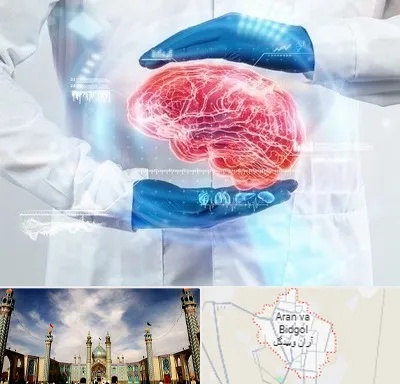 دکتر مغز و اعصاب در آران و بیدگل