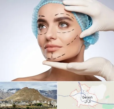 جراحی زیبایی در گراش