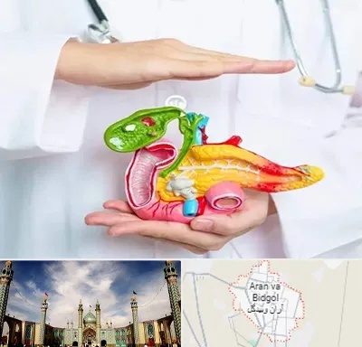 دکتر سرطان لوزالمعده در آران و بیدگل