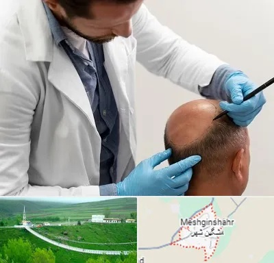کاشت مو به روش تکثیری در مشگین شهر