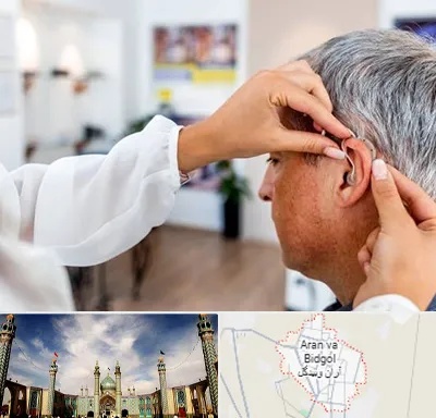 دکتر کم شنوایی در آران و بیدگل