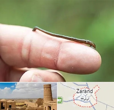 مرکز زالو درمانی در زرند