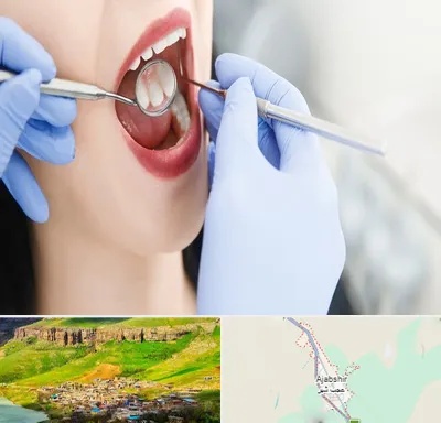 جراح دندان عقل در عجب شیر