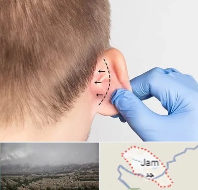 عمل زیبایی گوش در جم