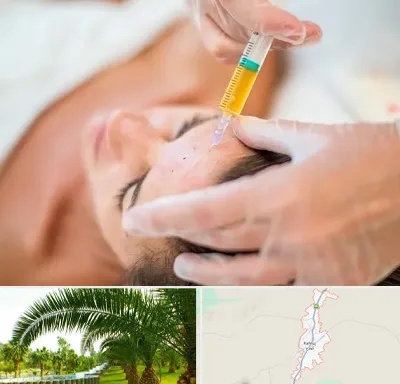 پی آر پی در کهنوج