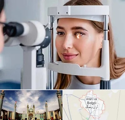 دکتر قوز قرنیه در آران و بیدگل