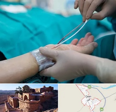 آنژیوگرافی در قائن
