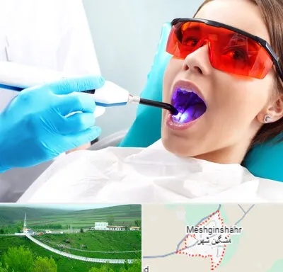 جراحی لثه با لیزر در مشگین شهر
