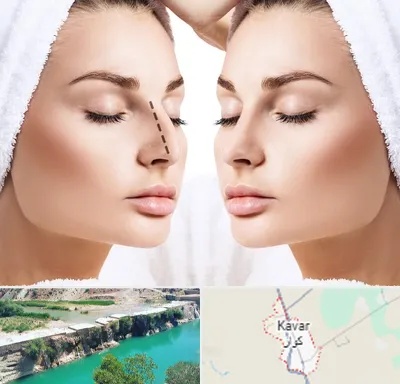 عمل بینی در کوار