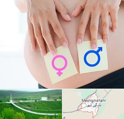 کلینیک تعیین جنسیت در مشگین شهر