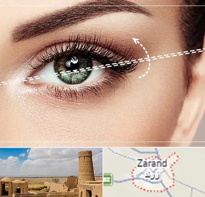 جراحی چشم گربه ای در زرند