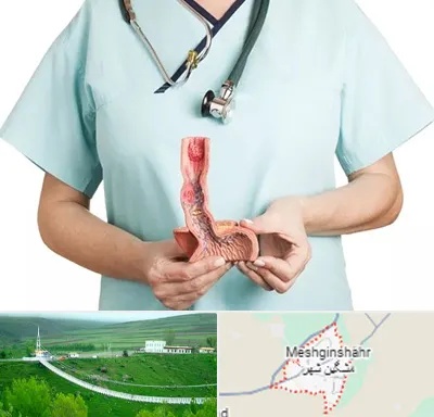 جراح سرطان مری در مشگین شهر