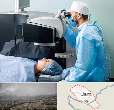 مرکز لیزیک چشم در جم
