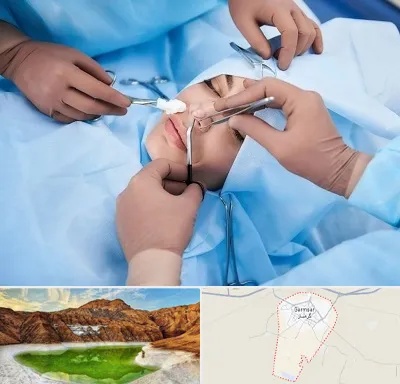 عمل بینی فانتزی در گرمسار