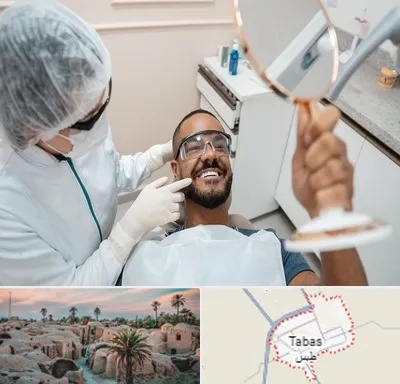 ایمپلنت فوری در طبس
