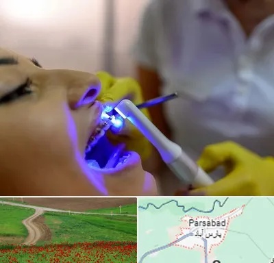 دندانپزشکی با لیزر در پارس آباد