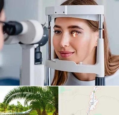 دکتر قوز قرنیه در کهنوج