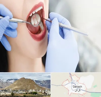 جراح دندان عقل در گراش