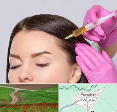 تزریق هیر فیلر در پارس آباد