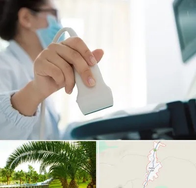 اکوی قلب در کهنوج