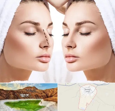 عمل بینی در گرمسار