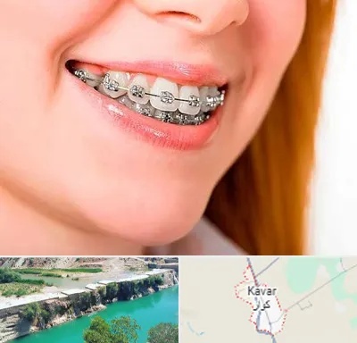 ارتودنسی ارزان در کوار