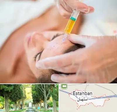 پی آر پی در استهبان
