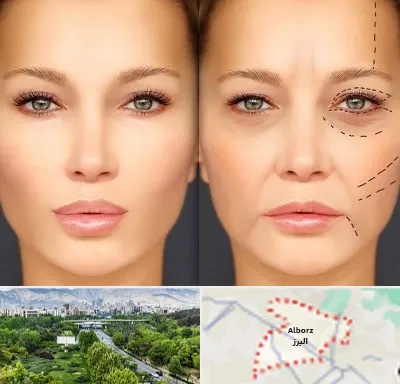 متخصص زیبایی چشم در البرز