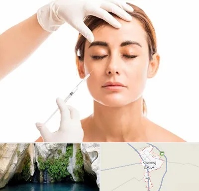 تزریق ژل گونه در خورموج