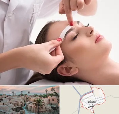اپیلاسیون در طبس