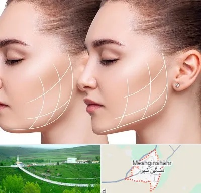 جراحی بوکال فت در مشگین شهر